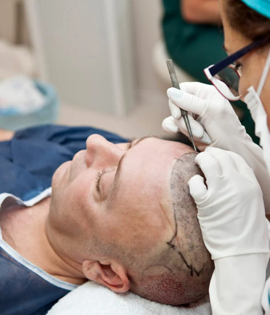 Hair Restoration