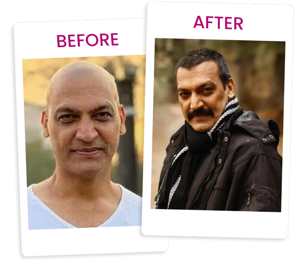 before--after